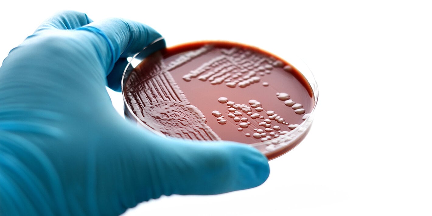 Gonorrhoea, caused by Neisseria gonorrhoeae, is the second most common bacterial STI and results in substantial morbidity and economic cost worldwide.